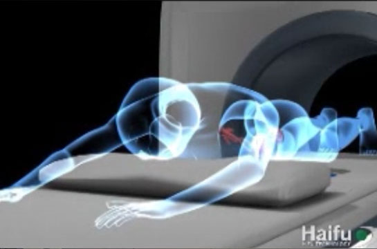 best365网站大全刀® JC型 聚焦超声肿瘤治疗系统