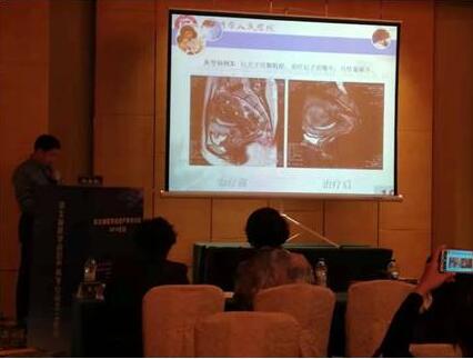 FUS技术亮相河北省医学会2018年妇产科学术年会