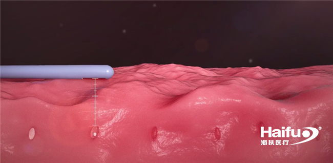 026292001618042829.png 3_副本.png