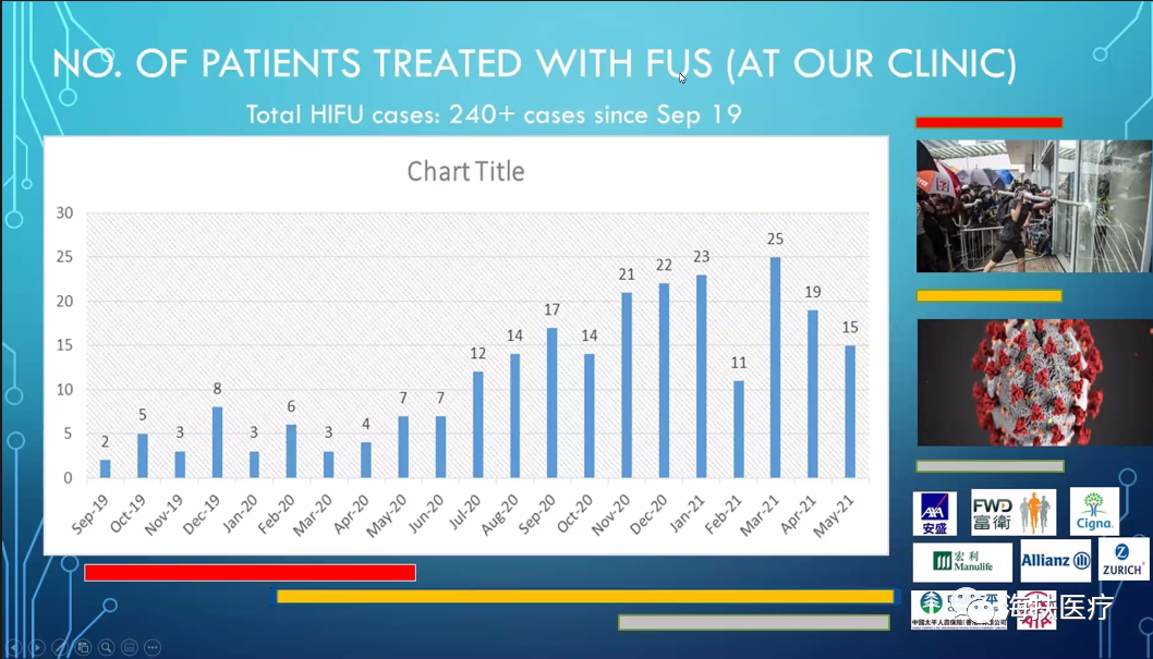 ISMIVS和APAGE联合举行：“2021年高强度聚焦超声（HIFU）”系列线上研讨会